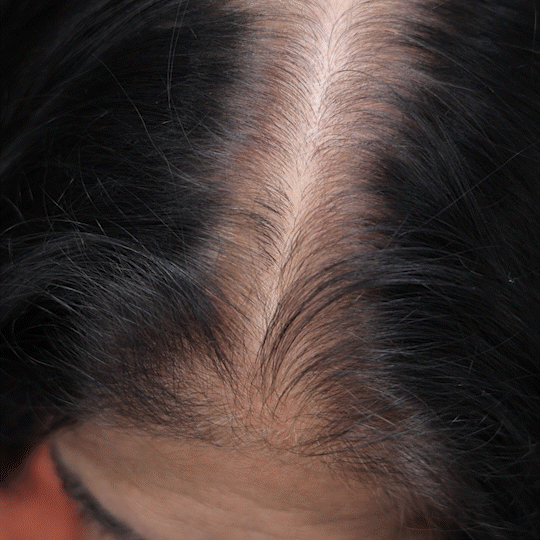 Eforra™ Hairline Powder (Black)