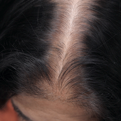 Eforra™ Hairline Powder (Black)