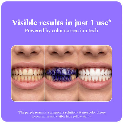 Eforra™ Teeth Whitening Strips
