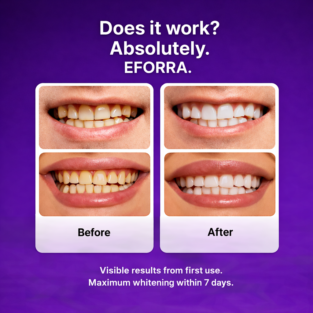 Eforra™ Teeth Whitening Strips