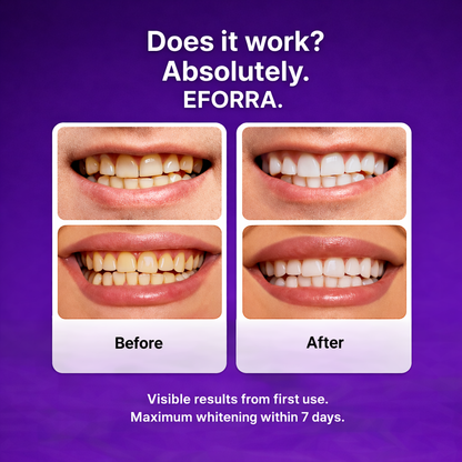 Eforra™ Teeth Whitening Strips