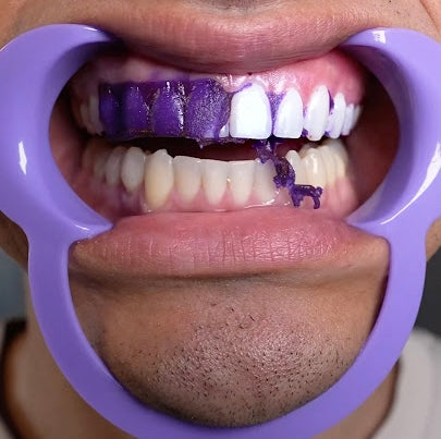 Eforra™ Purple  Teeth Whitening Strips
